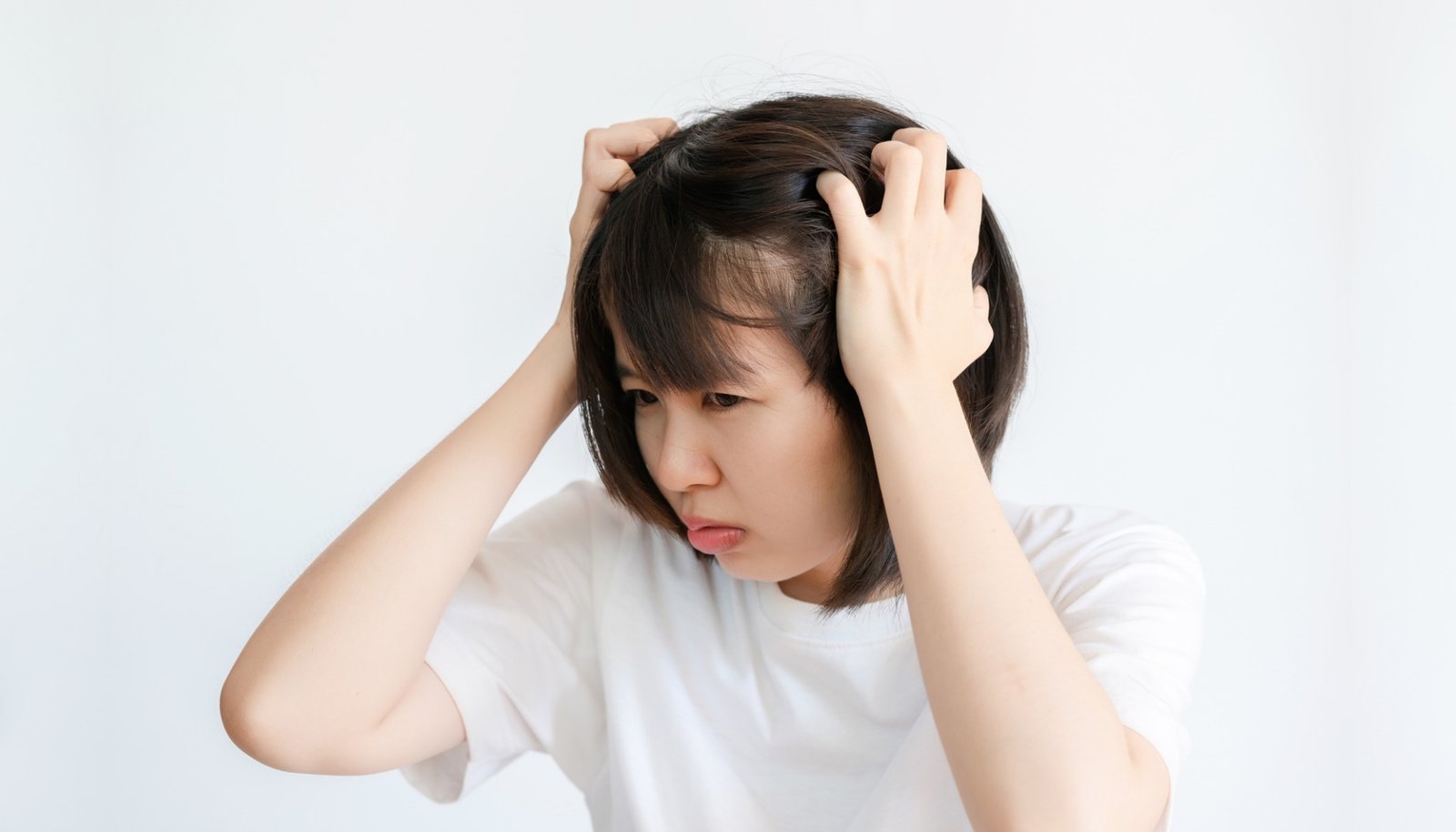 Mengatasi Kulit Kepala Gatal dengan Perawatan yang Tepat