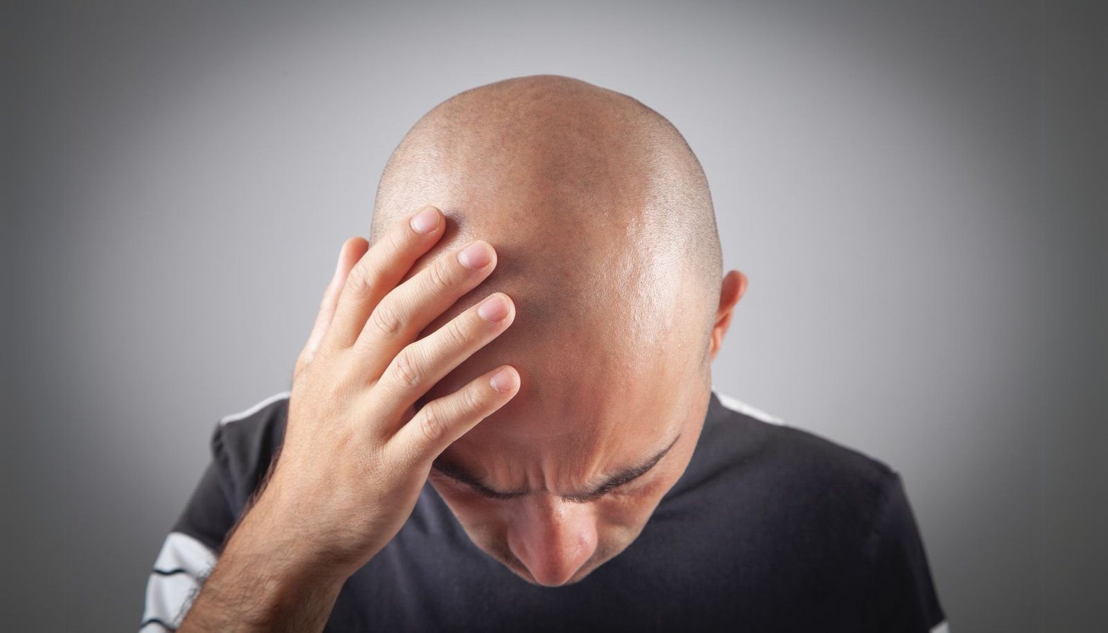 Cara Pria Berdamai dengan Kebotakan