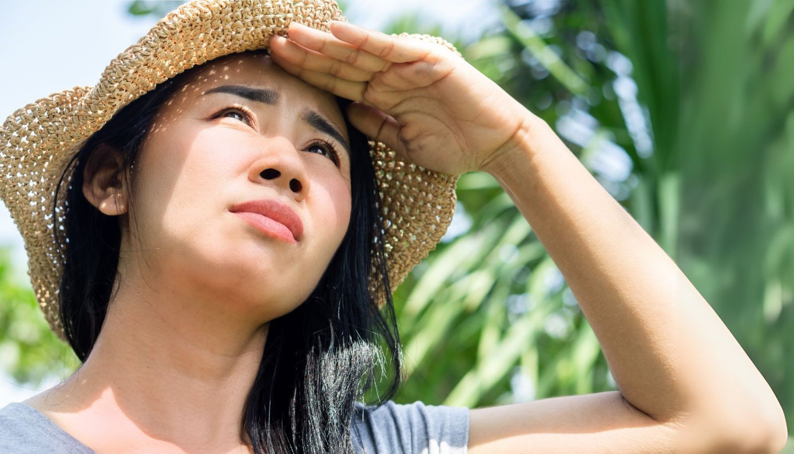 Pemulihan Kulit Belang karena Terbakar Matahari